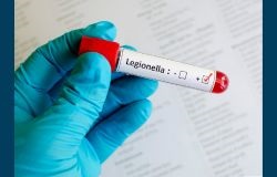 Legionella